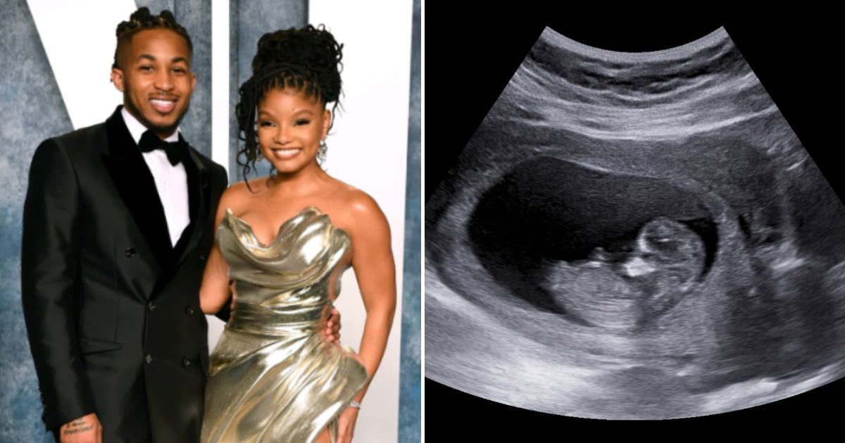 DDG had made the announcement about Halle Bailey's pregnancy on April Fool's Day in 2023 by sharing an ultrasound photo. At that time people thought it was a prank (Getty Images, @PontiacMadeDDG/X)