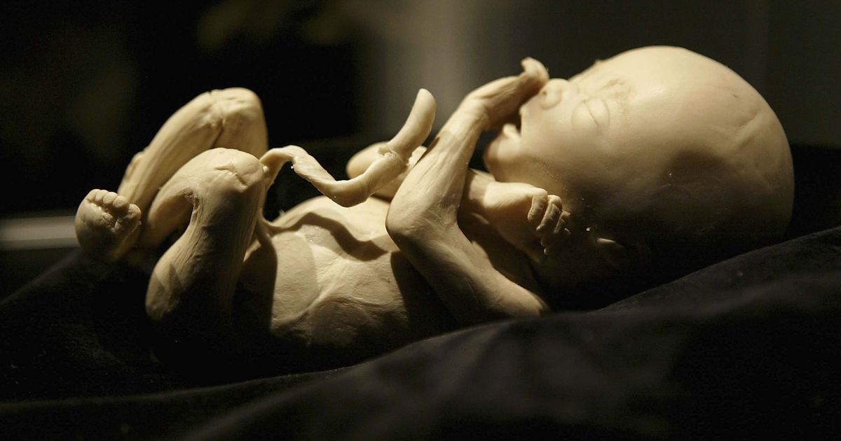 Matt Lampi has admitted his role in the buying and selling of stolen human remains from 2018 to 2022 (Getty Images)