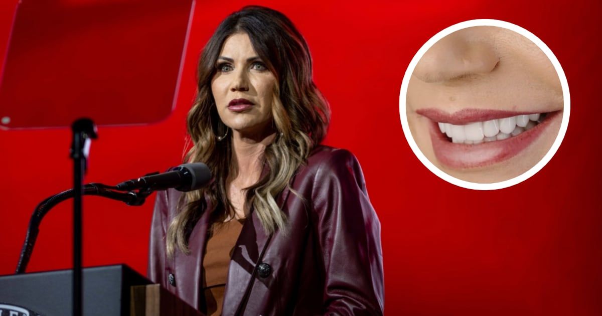 Kristi Noem opted to travel over 1,000 miles from her mansion in South Dakota to undergo dental procedures at Smile Texas (Getty Images, Kristi Noem/X)