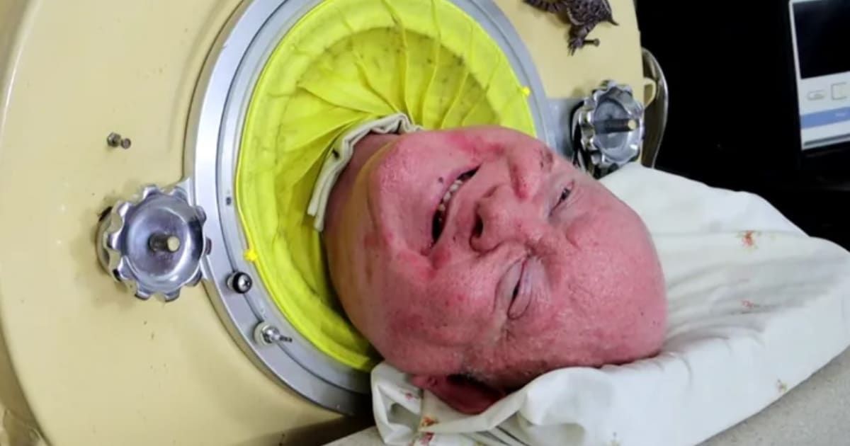 Paul Alexander, who held the guinness book of world record for longest-surviving man in the iron lung' dies at 78 (GoFundMe)