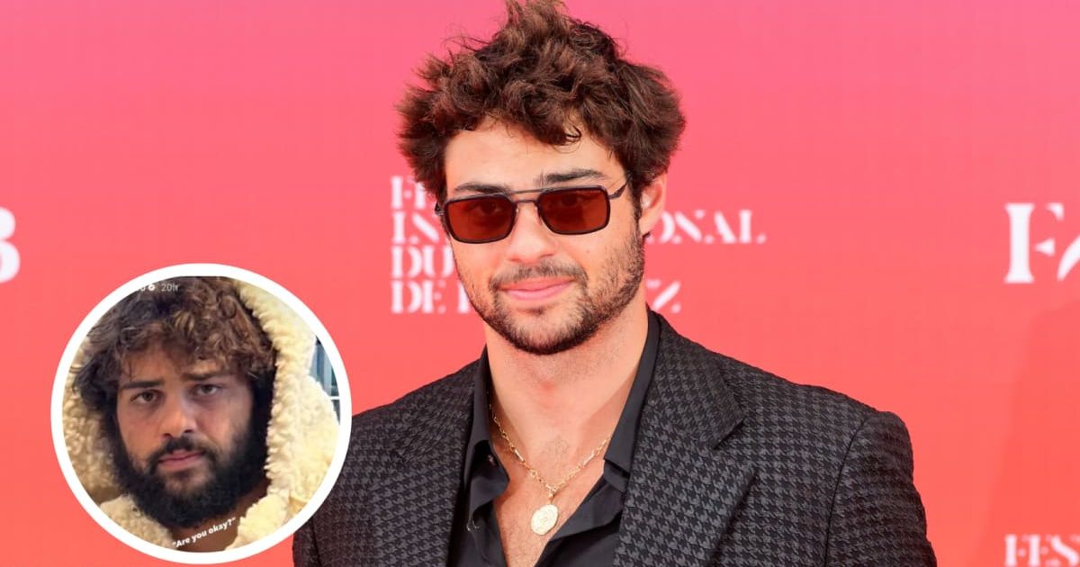 Noah Centineo shared a selfie that sparked major fan concern (Sylvain Lefevre/Getty Images, @PopCrave)