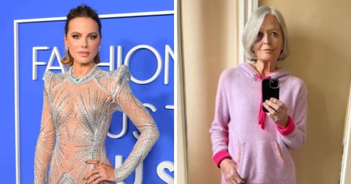 Kate Beckinsale made her fans anxious when she uploaded picture of mother who looked seriously injured (Getty Images and Instagram/@katebeckinsale)