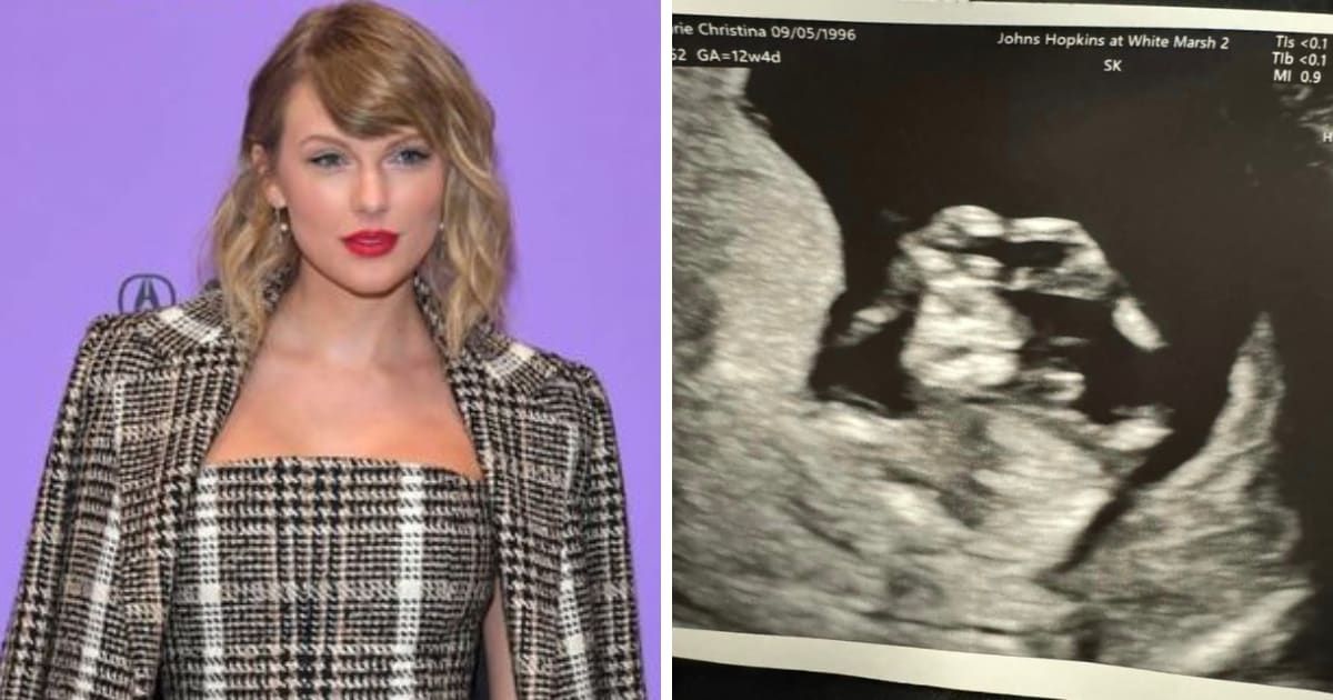 Taylor Swift's iconic heart-hands was seen in Swiftie's sonogram (Getty Images, Marie Smith/Facebook)