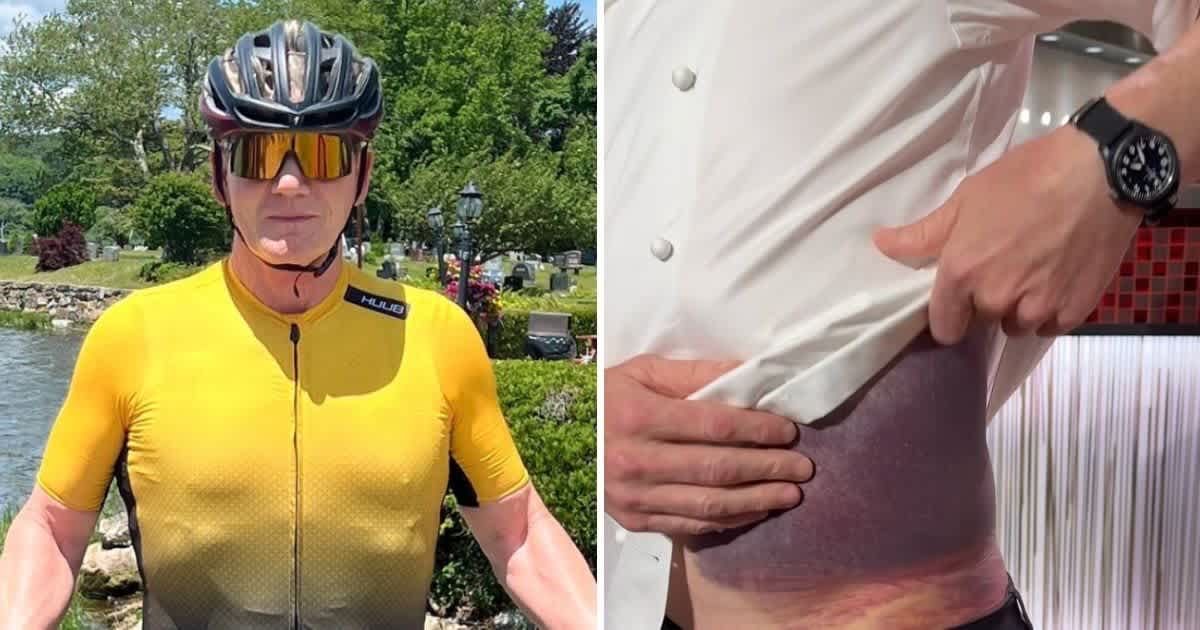 Gordon Ramsay advises to ‘wear helmets’ as he reveals bruised torso after ‘really bad’ cycling accident