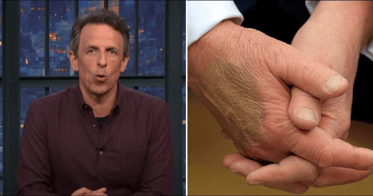 Seth Meyers trolls Trump after WH pins blame for his bruised hands on handshakes: 'He's basically a plum'