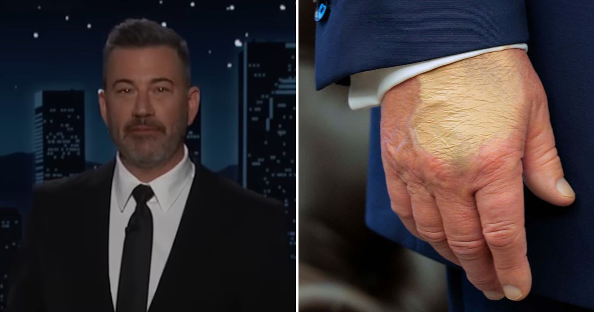Jimmy Kimmel takes jab at Trump’s ‘mysterious hand bruising’ and cover-up: ‘Sloppier than Epstein one’