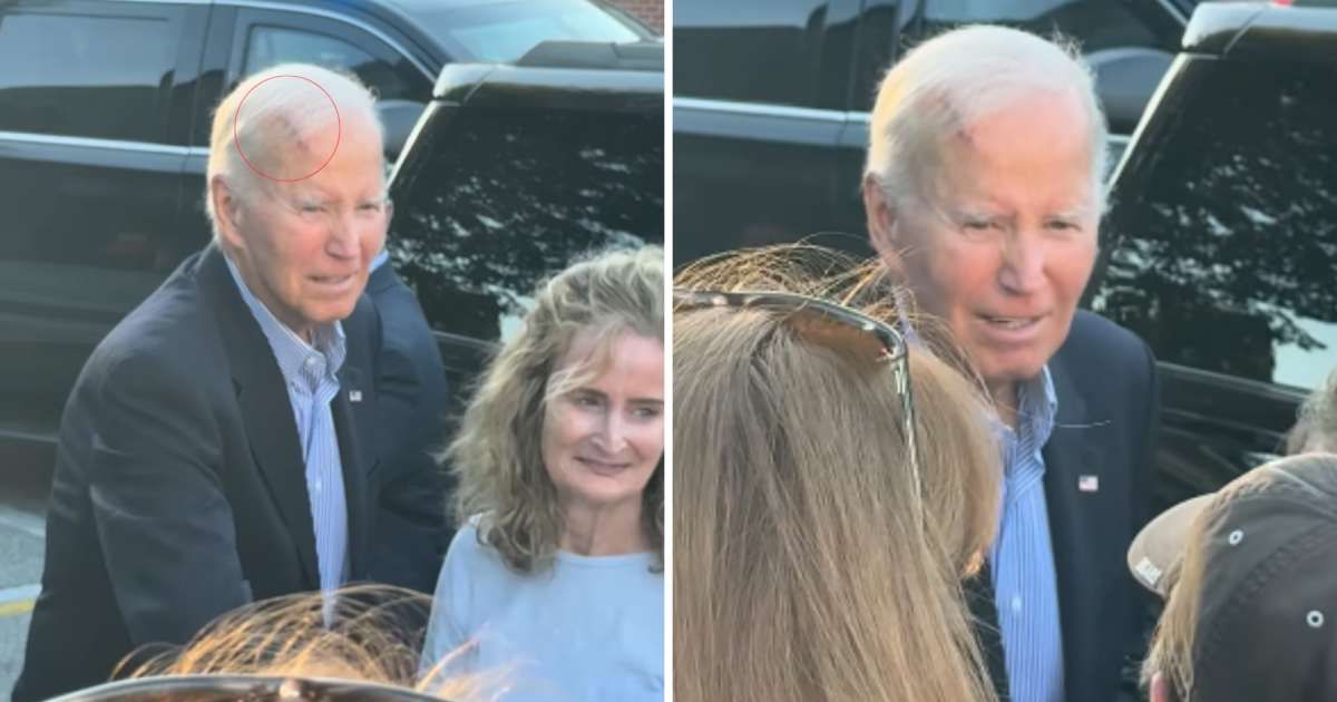 Biden seen with head gash during Delaware church visit, sparks health concerns