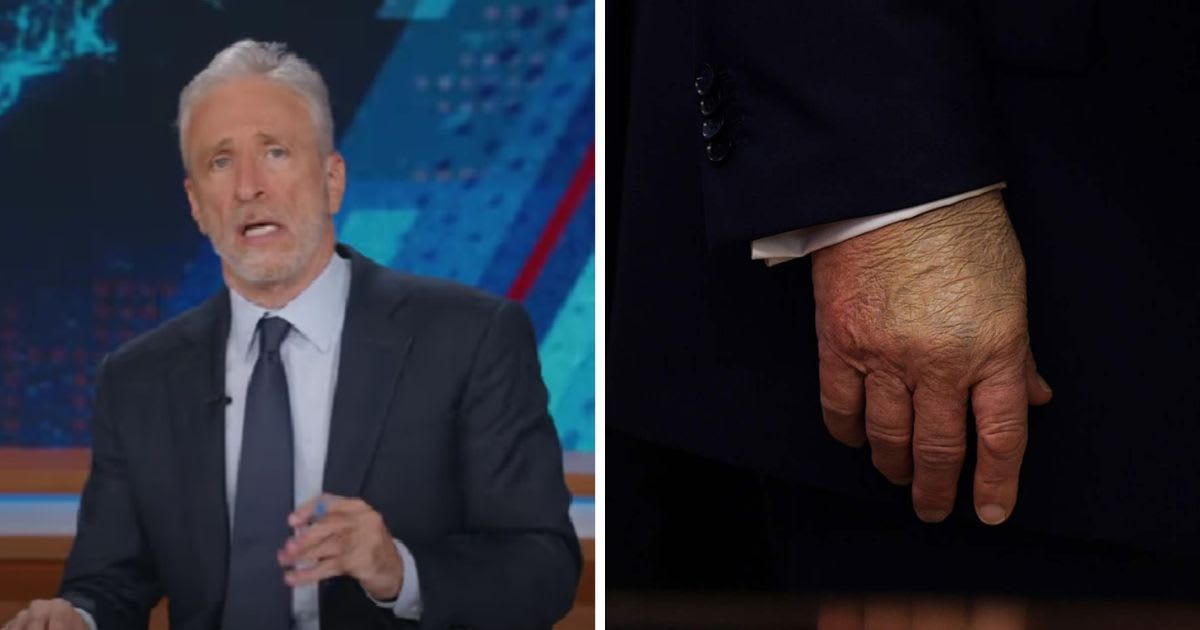 'He's clearly hiding something': Jon Stewart goes all in on Trump’s puffy ankles, hand bruises