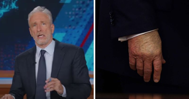 'He's clearly hiding something': Jon Stewart goes all in on Trump’s puffy ankles, hand bruises