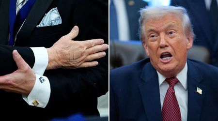 Trump's bandaged hand visible for fifth straight day at Kennedy Center Honors