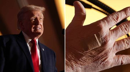 Trump appears with bandaged hand for seventh day amid speculations about his health