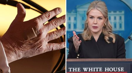Karoline Leavitt explains Trump’s hand bandages: ‘He is literally, constantly shaking hands’