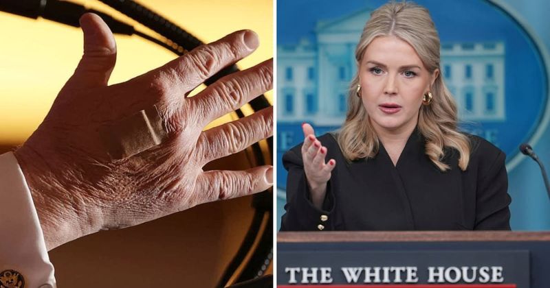 Karoline Leavitt explains Trump’s hand bandages: ‘He is literally, constantly shaking hands’