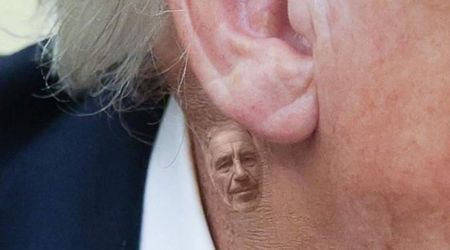 Democrats use Trump’s neck rash to mock him with Epstein jab