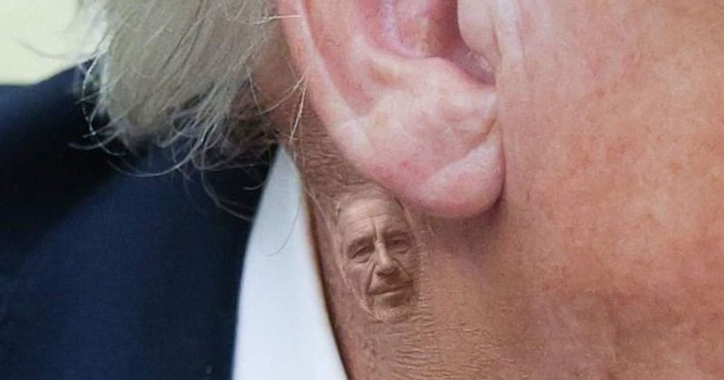 Democrats use Trump’s neck rash to mock him with Epstein jab