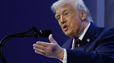 Trump seen with bruised hand at cabinet meeting, health concerns rise again