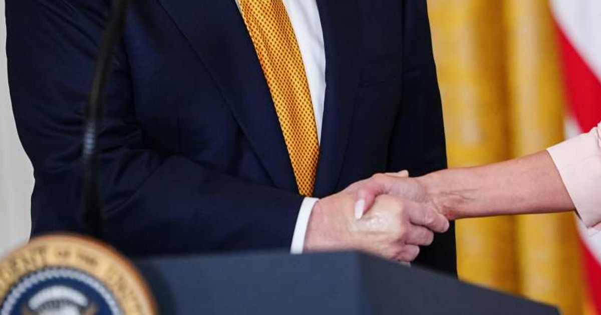 President Donald Trump's recent photos appeared to show both of his hands swollen and covered with noticeable makeup during a White House event (AP Photo/Julia Demaree Nikhinson)