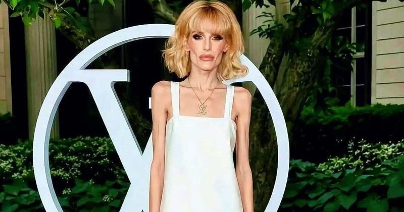 Fact Check: Is the photo of Kelly Osbourne looking extremely thin at a Louis Vuitton show real?