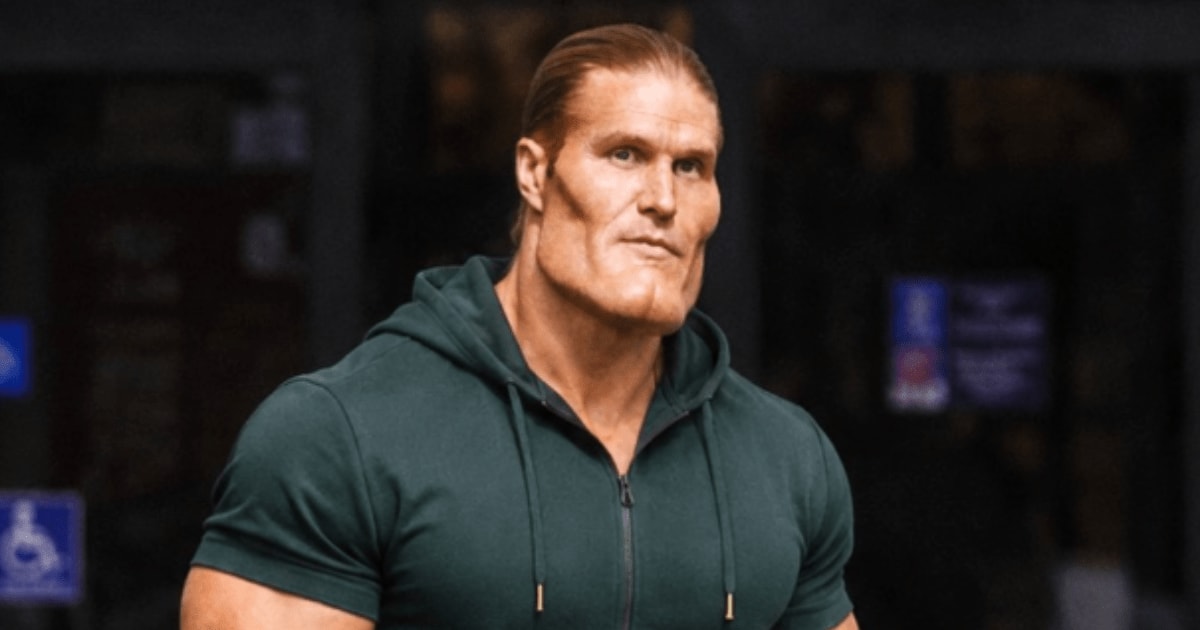 Clay Matthews reportedly had undergone plastic surgery (@tmz/X)