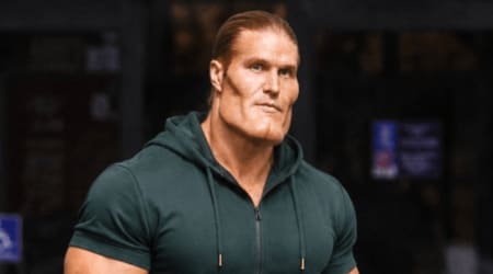 Fact Check: Did Clay Matthews undergo plastic surgery?